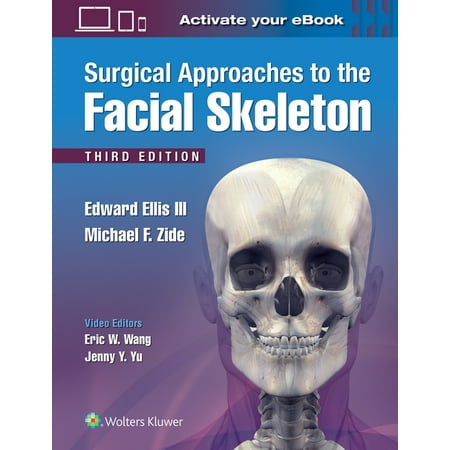 UPC: 9781496380418 | Surgical Approaches to the Facial Skeleton (Hardcover)