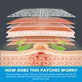 thumbnail image 4 of SKAYAH Pain Relief Patches 3.03" Ã? 6.30", Reusable Pain Patches Includes 3 Adhesives, 1 Patch & 1 Carry Bag, Relief Muscle Soreness, Knee, Foot, Shoulder, Neck, Back Pain P, 4 of 6