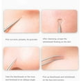 thumbnail image 3 of Blackhead Removal Tool, Pimple Popper Extractor Tool Kit, Used for Removing Blackheads, Acne, Comedone, Flaw White Heads on Nose and Face, Professional Stainless Steel Removal Tool., 3 of 5