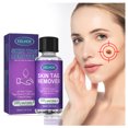 thumbnail image 2 of Líquido para eliminar verrugas y acrocordones, 30 ml, extractos naturales de plantas, elimina rápidamente callos y cicatrices de nevos, apto para todo tipo de pieles, uso doméstico, 2 of 8