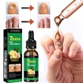 thumbnail image 3 of Tratamiento de uñas con jengibre, soporte para uñas, cuidado de uñas, 30 ml, IMOLL, 3 of 7