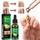 thumbnail image 3 of Tratamiento de uñas con jengibre, soporte para uñas, cuidado de uñas, 30 ml, IMOLL, 3 of 7