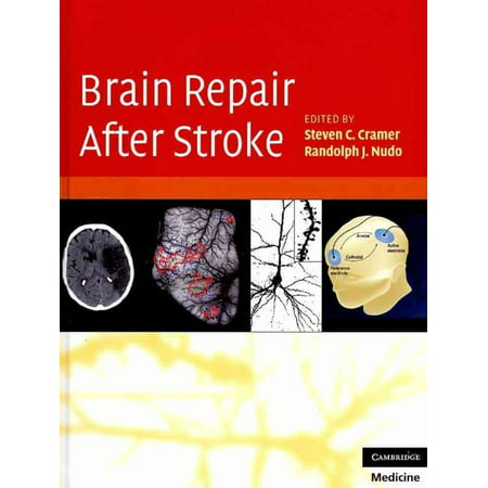 Brain Repair After Stroke (Hardcover)