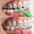 thumbnail image 2 of Stcellnmex Braces Flossers Interdental Brush Soft Dental Flossing Picks Oral Hygiene Cleaning Tool Cute Color 200 Pieces, 2 of 7