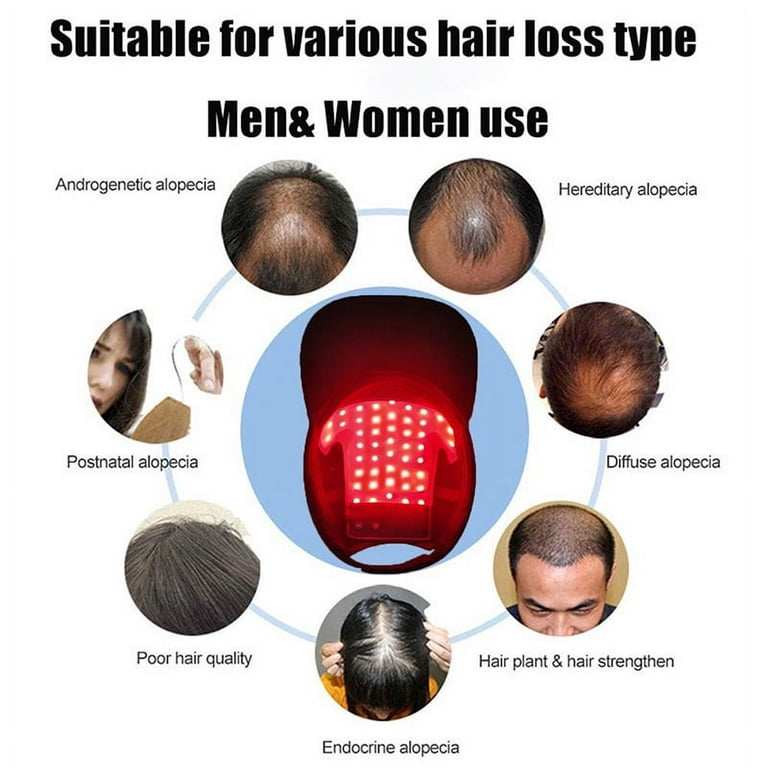 Red Light Therapy for Hair Growth and Baldness - ºdegree Wellness