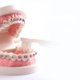 thumbnail image 2 of Cepillo de dientes de ortodoncia en forma de V con cerdas suaves (3 piezas), 2 of 4