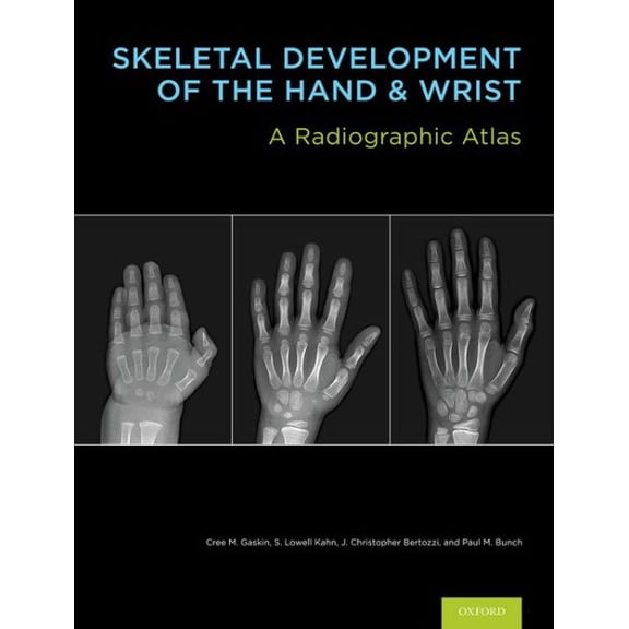 Pre-Owned Skeletal Development of the Hand and Wrist : A Radiographic Atlas and Digital Bone Age Companion