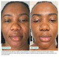 thumbnail image 2 of Sérums faciales Urban Skin Rx Youthhero AM/PM 2 en 1 30 ml, 2 of 7