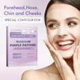 Uteam Hyaluronic Acid Acne Stickers Pimple Patches Reduce Pores for