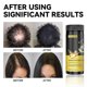 thumbnail image 3 of Cuidado del cabello con jengibre, nutrición hidratante, fuerte, anti-rotura, cuidado del cabello, cuidado del cabello negro, cuidado del cabello, jengibre en polvo | 8197392021705, como la imagen, 3 of 5