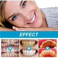 thumbnail image 5 of Eelhoe Jelly Cup Mouthwash Cleans Mouth Odor Tooth Stains Smoke Stains Brightens Teeth Care Fresh Breath 2pcs10pcs*10ml, 5 of 5