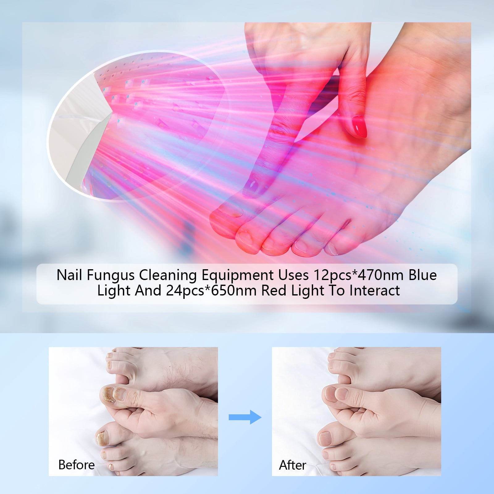 iKeener Rechargeable Nail Lamp Is Designed For Nail Fungus, With More Space