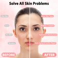 thumbnail image 4 of Jelly Mask Pjordo Professional, paquete de 10 unidades con cuencos para mezclar, 4 of 8