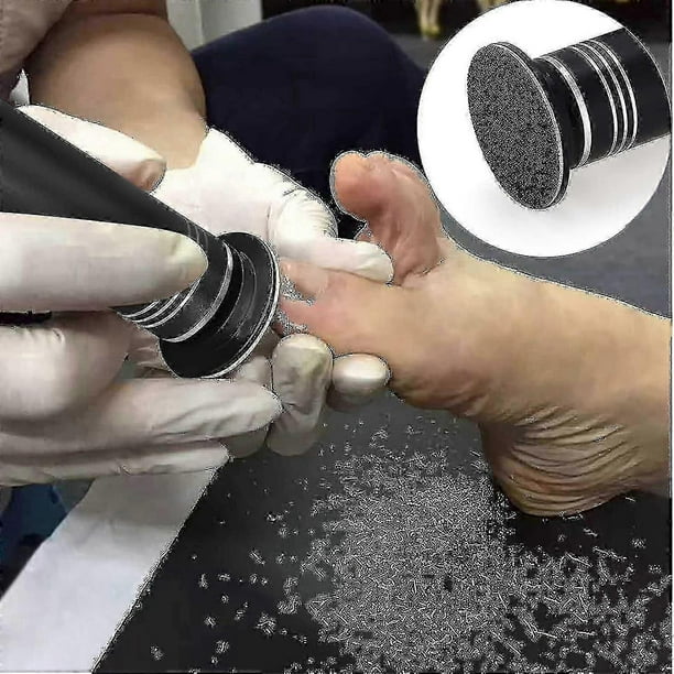 Upgraded Electric Callus Remover with Adjustable Speed & 60 Sandpaper Discs, Professional Foot File for Men & Women, Pedicure Sander for Dead Skin