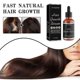 thumbnail image 2 of Jaysuing Dense Hair Essence Strong And Tough Hair Fixing Hair Root Thick Hairline Moisturizing Hair In Stock - 29Ml, 2 of 5