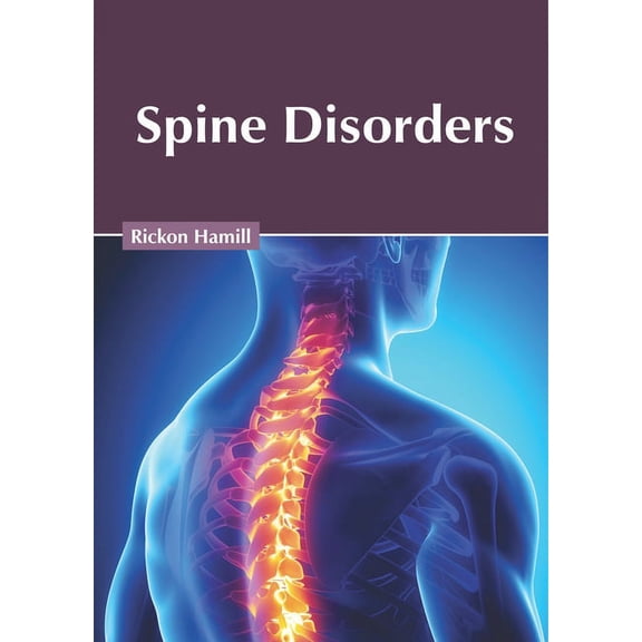 Spine Disorders, (Hardcover)