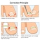 thumbnail image 3 of Juego De Herramientas De Pedicura Profesional, Recortador De Uñas De Los Pies, Fijador De Corrección De Uñas Encarnadas, Cuidado De Los Pies, 3 of 7