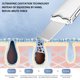 thumbnail image 4 of Espátula Exfoliante - Removedor de Puntos Negros, Limpiador de Poros, Raspador Facial, Extractor de Comedones, Espinillas y Granos, Limpieza Facial para Hombres y Mujeres, 4 of 6