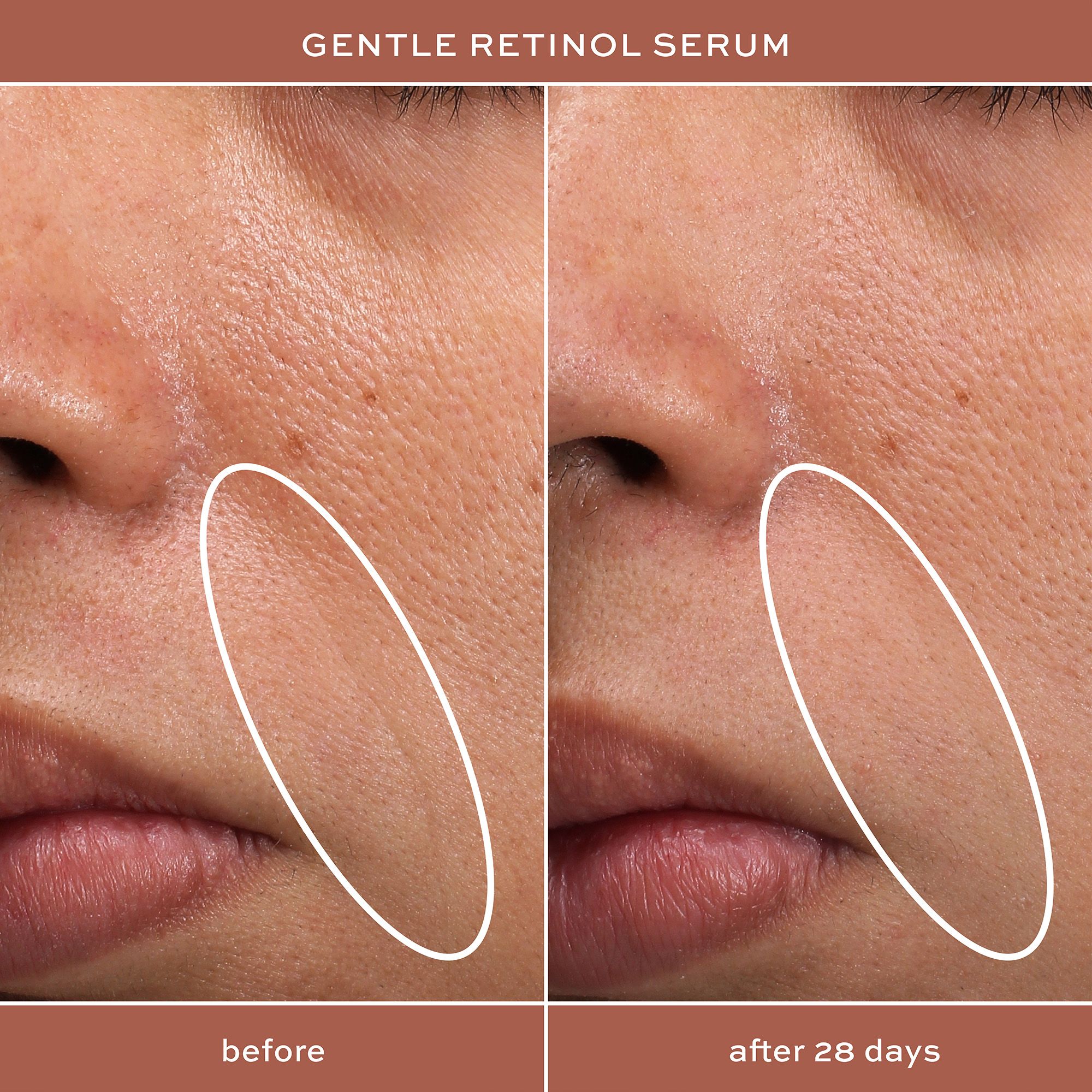 ITK Skincare Gentle Hydrating Retinol Facial Serum photo 5