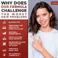 thumbnail image 2 of Suplemento Hairo Nutrition, bloqueador de DHT para el crecimiento del cabello, 2 of 3