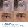 thumbnail image 3 of Crema para ojos Dr.Melaxin Eyephalt 10 ml con EGF y Bio-Spicule Tech, 3 of 9