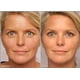 thumbnail image 2 of Gel de Retinol 0.1 Vitamin A Reparador de Líneas Finas y Arrugas, 2 of 6