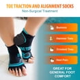 thumbnail image 4 of Toe Separator Socks by Stretch; Toe Spacer Foot Alignment Sock for Bunion Relief, 4 of 7