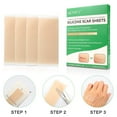 thumbnail image 7 of Aliver 4Pcs Silicone Scar Sheets Scar Tape, 2 Months Supply Professional Scar Removal Strips, 7 of 7