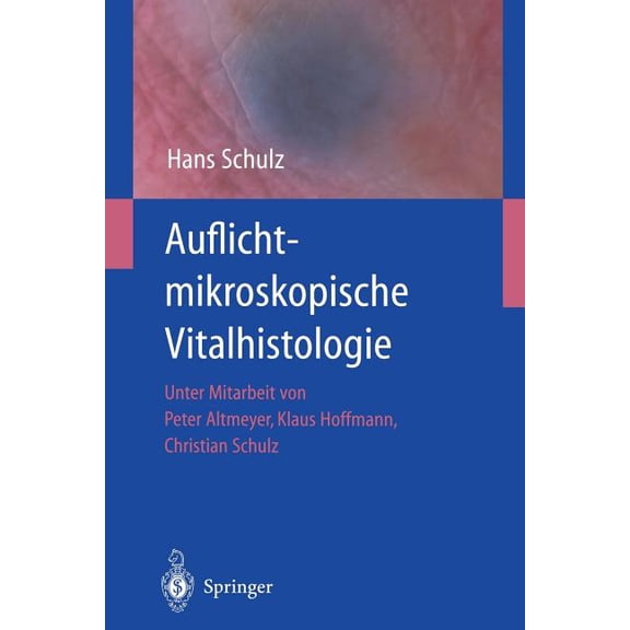 Auflichtmikroskopische Vitalhistologie: Dermatologischer Leitfaden, (Paperback)