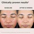 thumbnail image 3 of Protector solar EltaMD UV Skin Recovery Face SPF 50 para piel sensible, 3 of 7