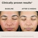 thumbnail image 3 of Protector solar EltaMD UV Skin Recovery Face SPF 50 para piel sensible, 3 of 7