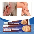 thumbnail image 4 of Vein Repair Leg Improves Soreness Muscle & Joint Massage For Sedentary Workers/Relaxation After Deep Penetration &Refreshing Makeup Organizers, 4 of 7