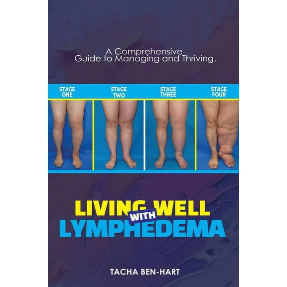 Living Well with Lymphedema: A Comprehensive Guide to Managing and Thriving (Paperback) by Tacha Ben-Hart