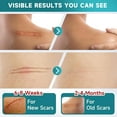 thumbnail image 5 of Pumkot 3 Rolls Silicone Scar Sheets, Medical Grade Silicone Scar Tape, Scar Removal Strips for Acne, Burn Scars C-Section, Keloid Surgery Scars Sheets, 5 of 8