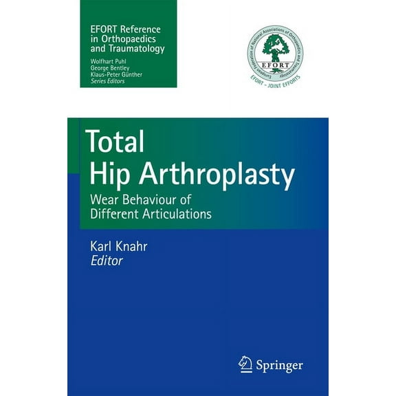 Total Hip Arthroplasty: Wear Behaviour of Different Articulations, (Paperback)