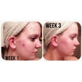 thumbnail image 4 of Spray de sal marina CreekBaby Organic para rostro, cuerpo y cabello, 240 ml, 4 of 9