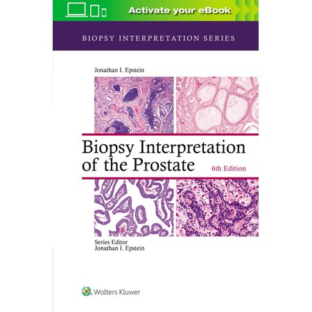 UPC: 9781975136543 | Biopsy Interpretation: Biopsy Interpretation of the Prostate (Hardcover)