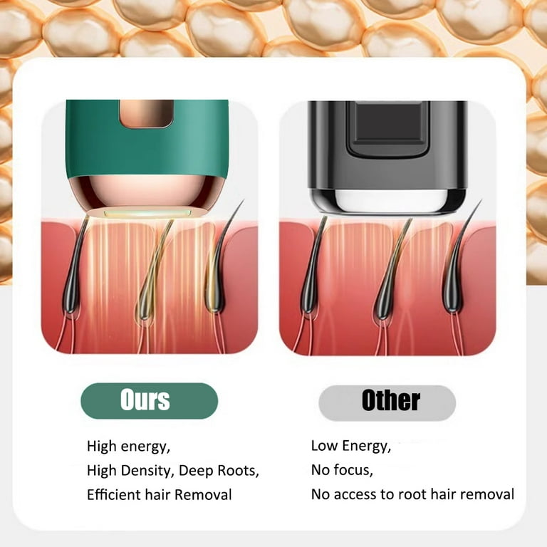 Laser Hair Removal for Women and Men,Depilacion laser，IPL Hair