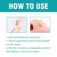thumbnail image 5 of Wound Repair Solution For Redness, Swelling And Discomfort Of The Skin, 5 of 5
