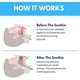 thumbnail image 5 of Anti Snoring Mouthpiece, 2025 New Anti Snoring Mouthpiece, The Quite Night Anti snoring Device, Mouth Guard for Women and Men,Soft and Comfortable, 5 of 5