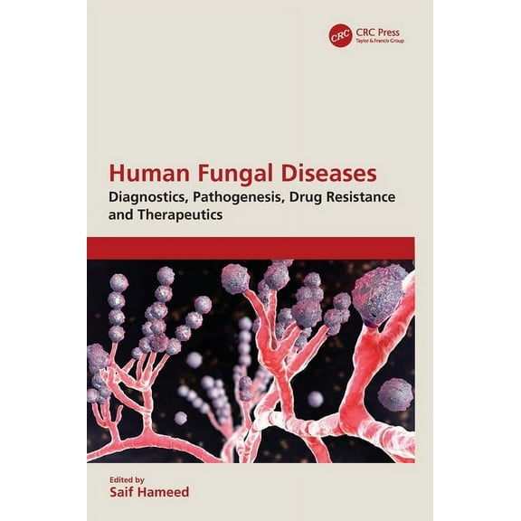 Human Fungal Diseases: Diagnostics, Pathogenesis, Drug Resistance and Therapeutics, (Hardcover)