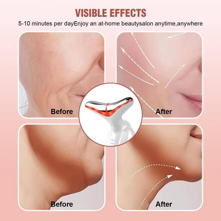 Banome Red Light Therapy for Face, 7 Color LED Facial Light Therapy, RED Light Device(White)