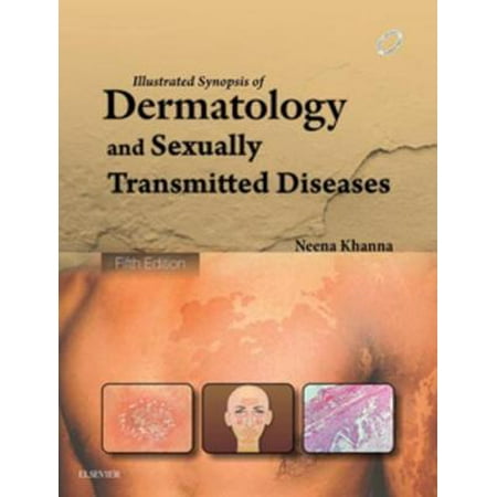 Illustrated Synopsis of Dermatology & Sexually Transmitted Diseases - E-book -