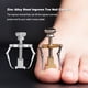 thumbnail image 5 of Qarigey Toe Nail Fixer Corrector Ingrown Paronychia Tratamiento Groove Steel Recover Pedicura Uña Pie Ortesis Acronyx Ayudas para vestirse con gancho de botón plata, 5 of 6