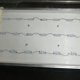 thumbnail image 4 of Fliter compatible con reparación de televisores LED de 32 a 65 pulgadas (20 piezas 6 V), 4 of 5