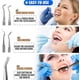 thumbnail image 5 of Herramientas dentales, paquete de 10 herramientas profesionales para eliminar la placa, juego de herramientas de limpieza de dientes, kit de higiene de cuidado bucal de acero inoxidable con limpiador Namotu CZMR-XM111, 5 of 7