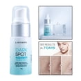 thumbnail image 4 of Removedor de manchas oscuras Corrector en crema de desvanecimiento de pecas Yuyangstore Removedor de manchas oscuras, 4 of 8