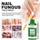 thumbnail image 1 of Esencia de reparación de uñas 30ml Aceite de nutrición para uñas Tratamiento de uñas Aceite de esencia Tratamiento de uñas natural para uñas y Colco Aceite de esencia de uñas, 1 of 8