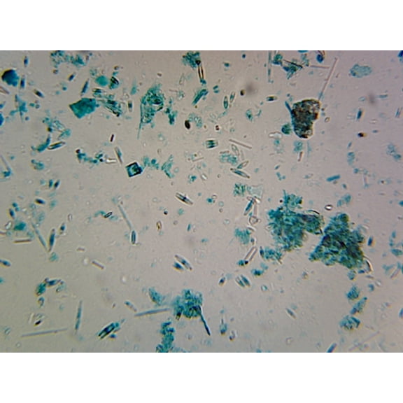 Diatomeae (Comparing Various Mixed Diatoms); Whole-mount by Go Science Crazy