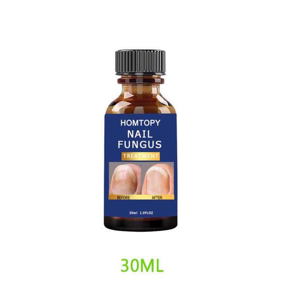 Nail and toe fungus treatment: hongos Extra Strength Liquid Fungus Remover - Nail Fungus Care (30ml)